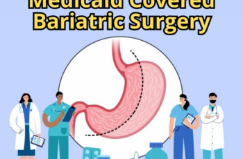 Understanding Medicaid covered bariatric surgery options
